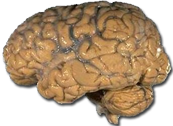 Human_brain_NIH